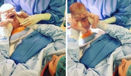 Mẹ trẻ tự nhấc con ra khỏi bụng trong ca sinh mổ